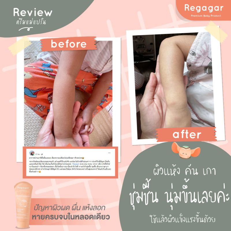 Regagar โลชั่นทาผิวเด็ก 200 mL (Baby everyday Body lotion), 2 ชิ้น Regagar โลชั่นทาผิวเด็ก 200 mL (Baby everyday Body lotion), 2 ชิ้น - %e0%b8%84%e0%b8%a3%e0%b8%b5%e0%b8%a1%e0%b8%9a%e0%b8%b3%e0%b8%a3%e0%b8%b8%e0%b8%87%e0%b8%9c%e0%b8%b4%e0%b8%a7 -