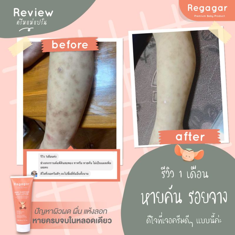 Regagar โลชั่นทาผิวเด็ก 200 mL (Baby everyday Body lotion), 2 ชิ้น Regagar โลชั่นทาผิวเด็ก 200 mL (Baby everyday Body lotion), 2 ชิ้น - %e0%b8%84%e0%b8%a3%e0%b8%b5%e0%b8%a1%e0%b8%9a%e0%b8%b3%e0%b8%a3%e0%b8%b8%e0%b8%87%e0%b8%9c%e0%b8%b4%e0%b8%a7 -